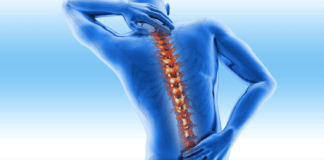 Effective Natural Health Remedies for Ankylosing Spondylitis