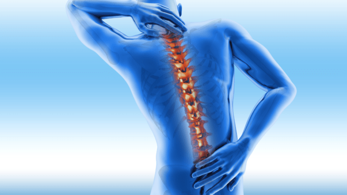 Effective Natural Health Remedies for Ankylosing Spondylitis